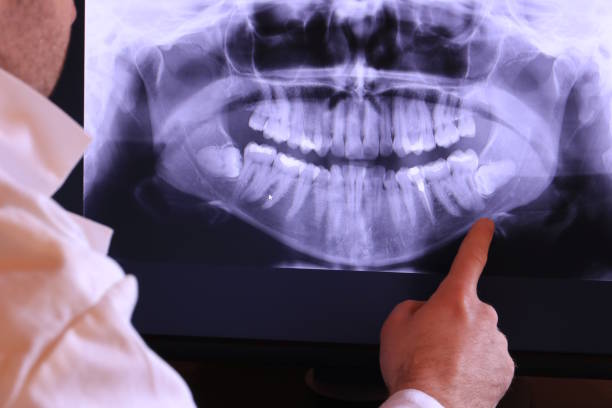 Best Emergency Dental Care for Trauma or Injury in Katy, TX